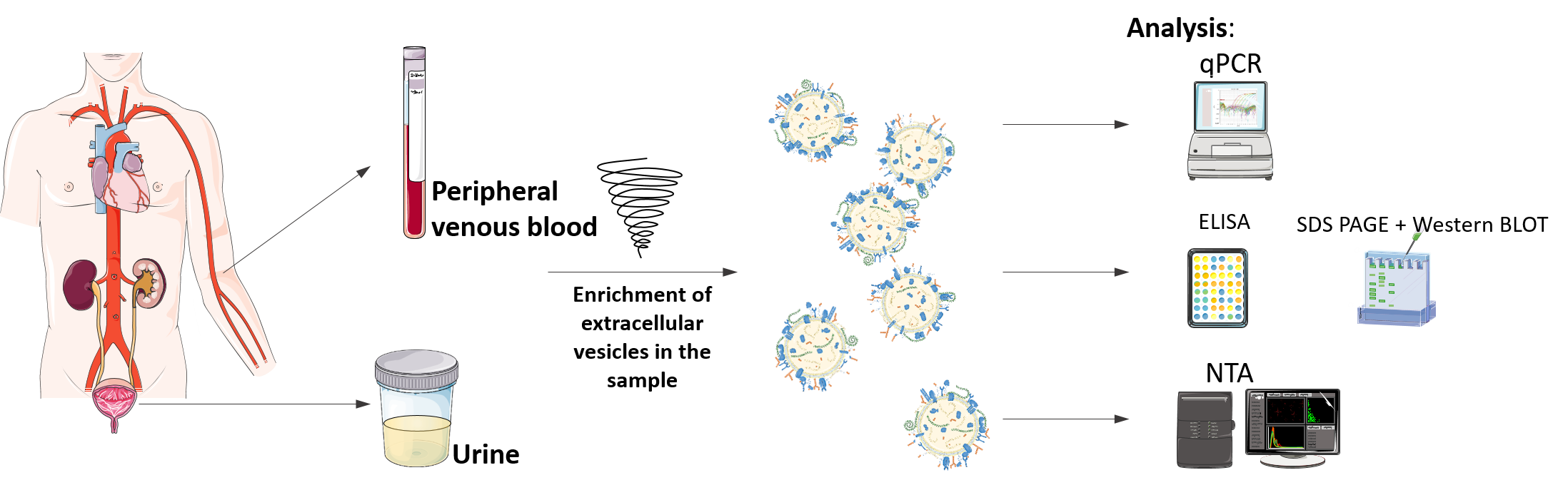 Extracellular vesicles as biomarkers of disease